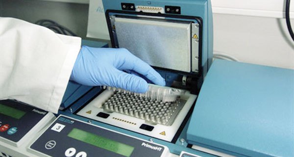 Faults on PCR machine of Mulleriya…