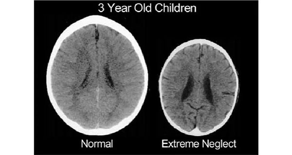 Child abuse is mostly happened at home! – National Child Protection Authority