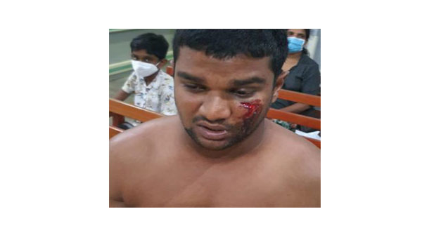 Police brutal on law student…
