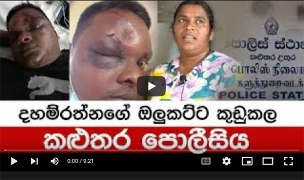 Kalutara police smash daham ratna’s skull | police torture in kalutara