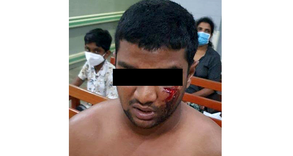මිගාරට පහර දුන් පොලිස් නිලධාරීන්ගේ වැඩ තහනම් !