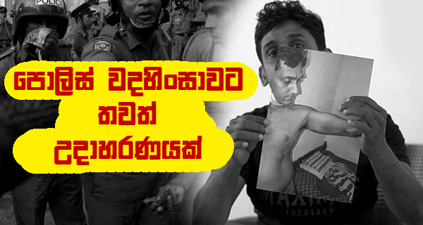 පොලිස් වදහිංසාවට තවත් උදාහරණයක්!