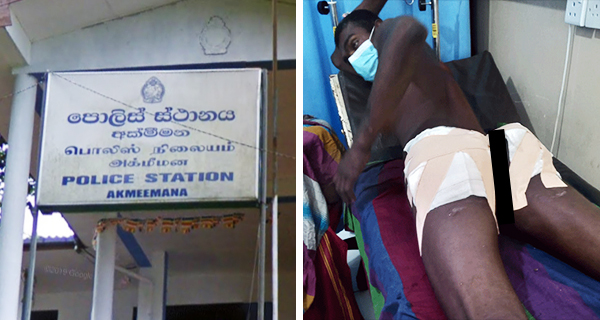 තට්ටම් පලන අක්මීමන පොලීසිය