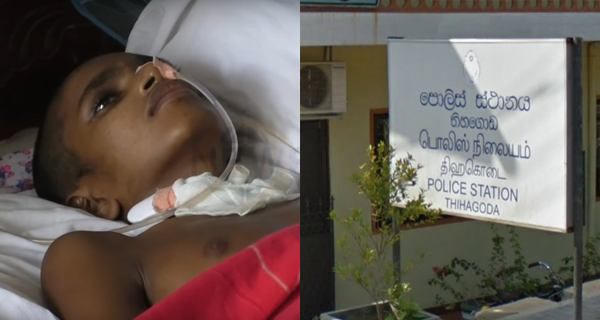 Thihagoda police shoot torture