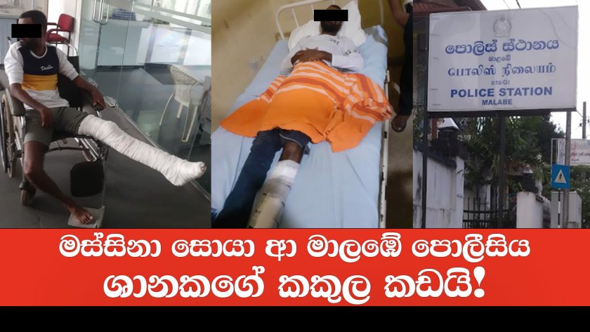 මස්සිනා සොයා ආ මාලඹේ පොලීසිය ශානකගේ කකුල කඩයි!