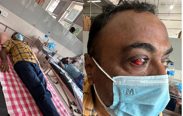 මහබාගේ පොලිස් නිලධාරීන් විශ්‍රාමික OIC ට පහරදීලා – ඇසකට බරපතළ හානි