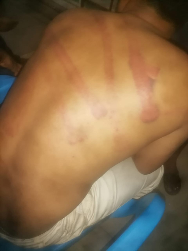 තරුණයන් දෙදෙනෙකුට පහරදීම සම්බන්ධයෙන් පමුණුගම පොලීසියේ තිදෙනෙකුගේ වැඩ තහනම්