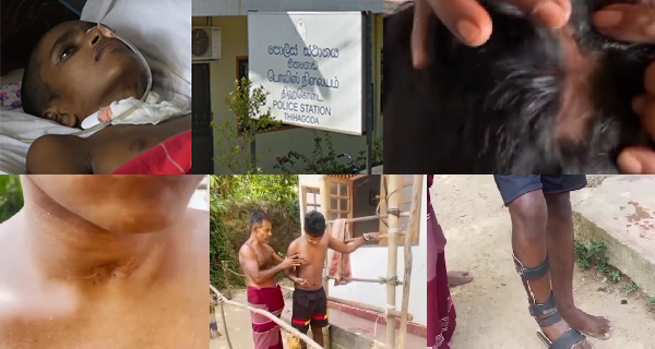 පාසල් සිසුවාට වෙඩි තැබූ තිහගොඩ පොලිසියට එරෙහි නඩුව විභාගයට අවසර!
